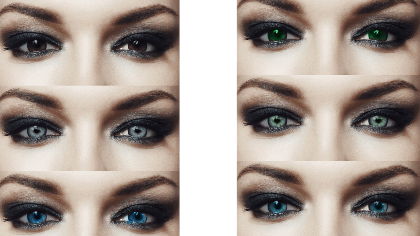 Can You Really Change Your Eye Color Forever? Unveiling Keratopigmentation